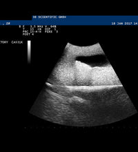 SONOtrain Ultrasound Vein model