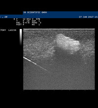 SONOtrain Breast model with tumours