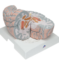 Giant Human Brain Model, 2.5 times Full-Size, 14 part - 3B Smart Anatomy
