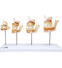 Dentition Development Model - 3B Smart Anatomy