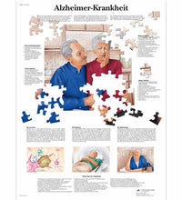Alzheimer-Krankheit