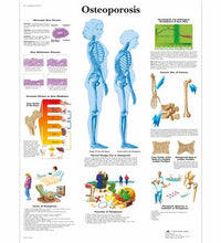 Osteoporosis Chart