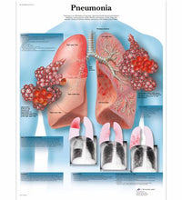 Variant Image (shared)