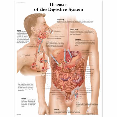 Digestive System Problems Diseases of the Digestive System Chart