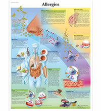 Allergies Chart