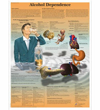 Alcohol Dependence Chart