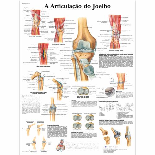 A Articulacao do Joelho, 50x67 cm, Versao Papel