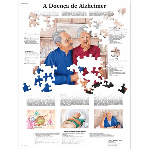 A doença de Alzheimer, 50x67 cm, Versao Papel