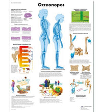 Osteoporosis Chart