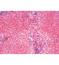 Human Pathology - German Slides