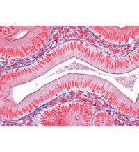 Variant Image (shared)