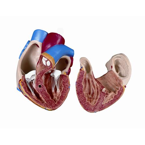 Spare heart, 2 parts