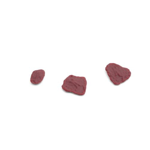 Placenta residual pieces 1 set