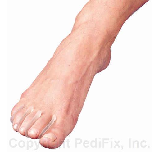 Visco-GEL® Toe Separators™