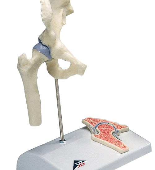 Mini hip joint with cross section of bone on base