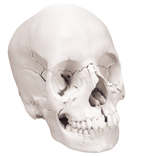 Anatomical skull, Beauchene 22-part