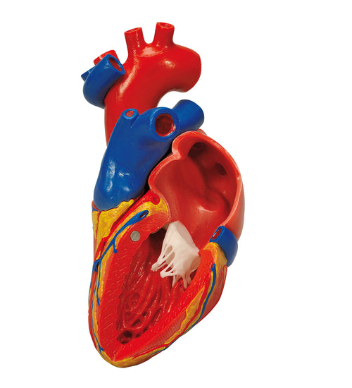 Heart with bypass, 2-part