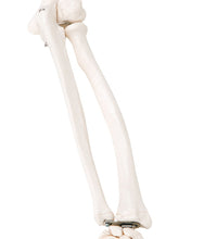 Loose bones, arm skeleton (wire)