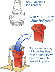 Anti-Reflux Valve