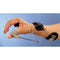 Bunnell Oppenheimer Spring Wire Orthosis